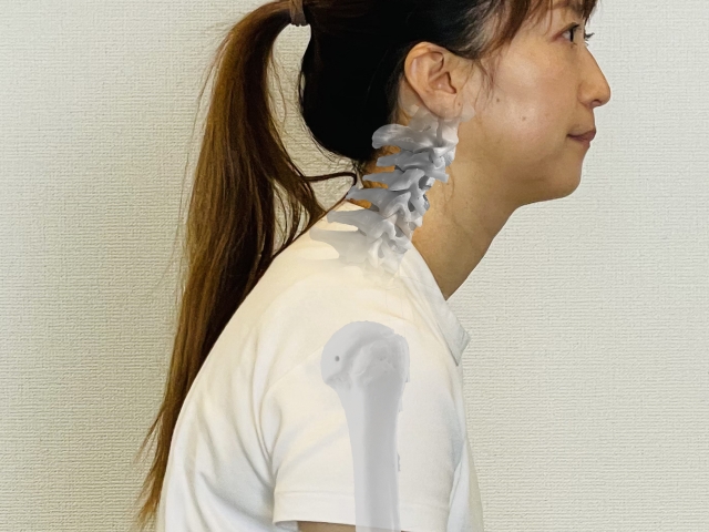 ストレートネックの図